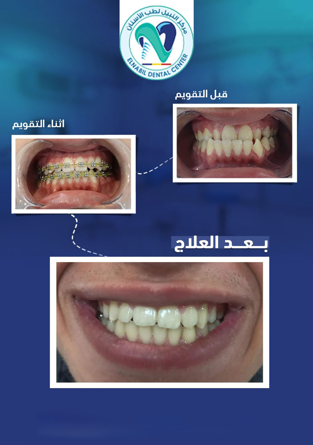 orthodontics