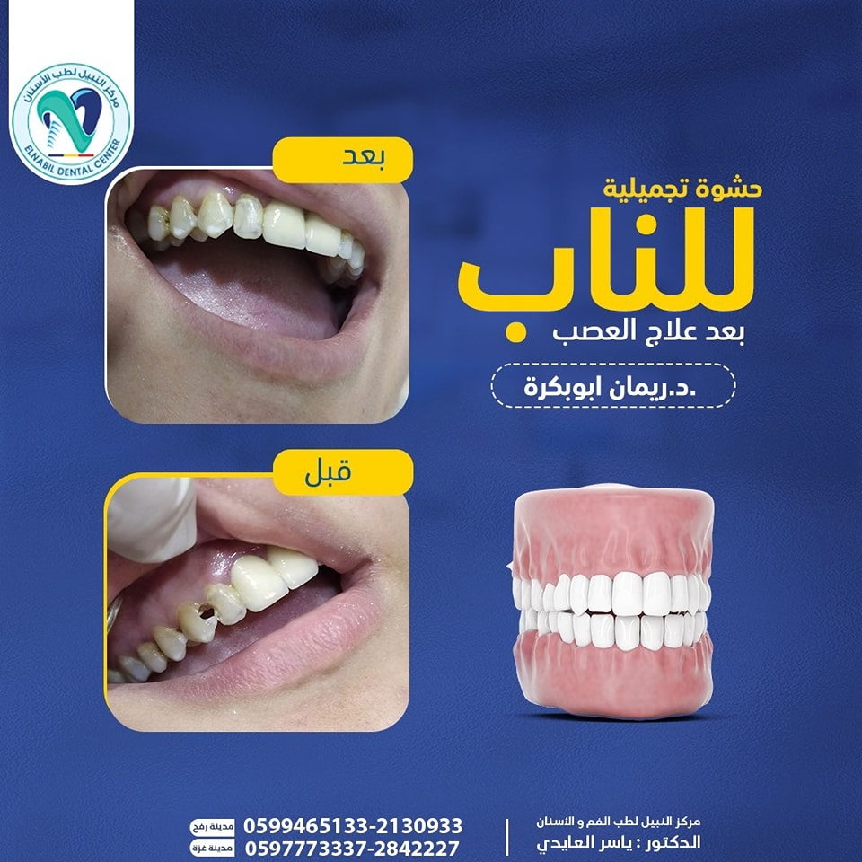 Endodontics